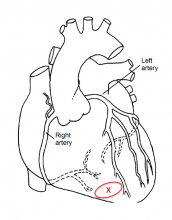 Blood flow through coronary